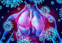 Waspada Badai Sitokin Saat Pandemi Covid-19